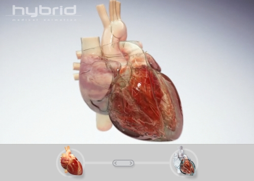 Hybrid Medical Animation